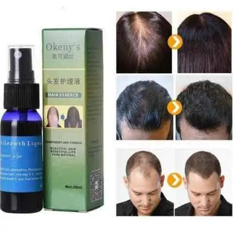 Buy Organic Hair Growth Essence - Natural Solution for Stronger Hair